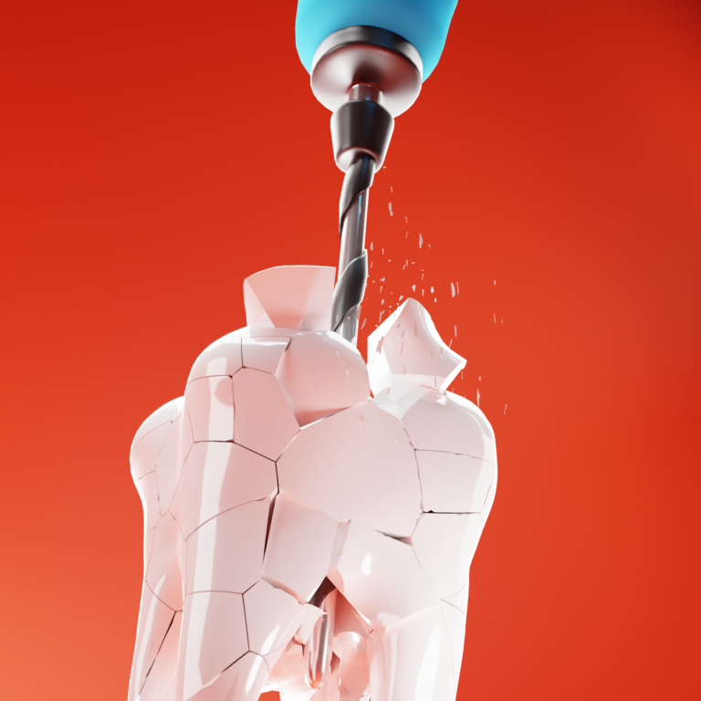 Day 35: How it really feels at the Dentist